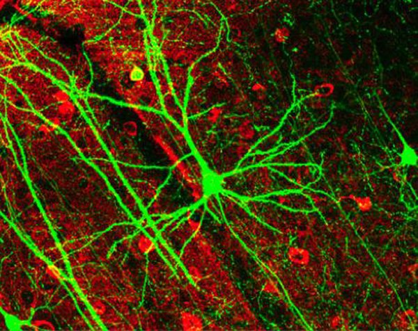 neuronas